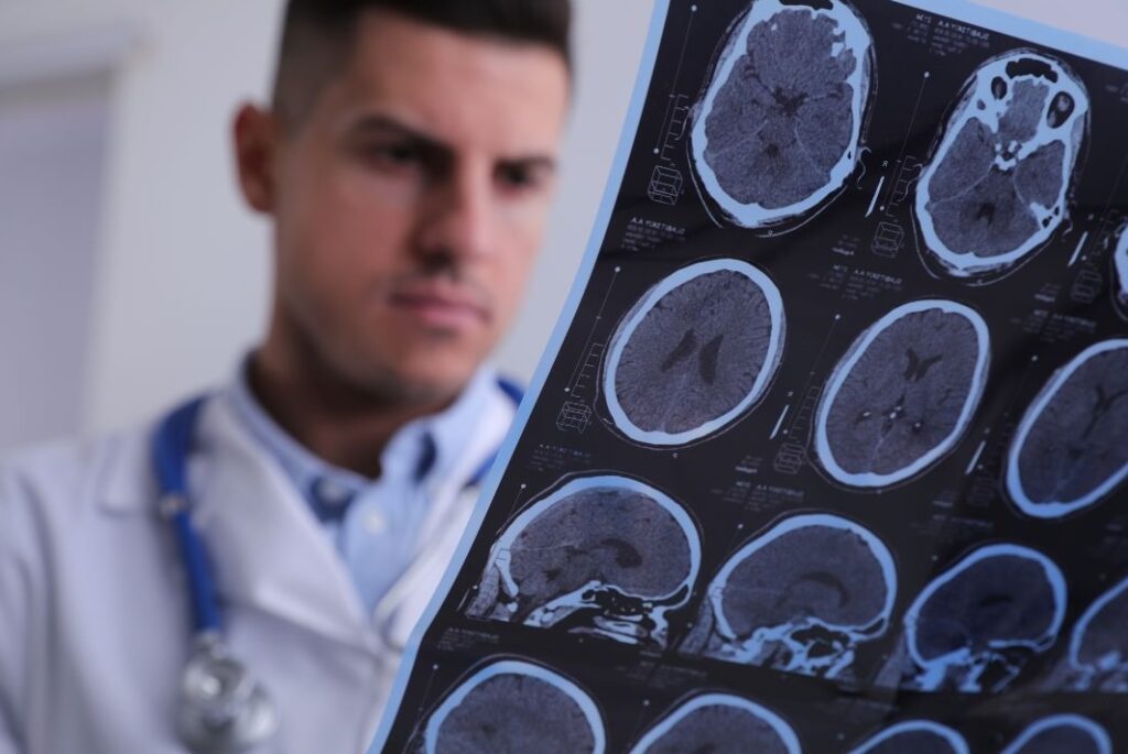 doctor looking at brain scan from MS patient